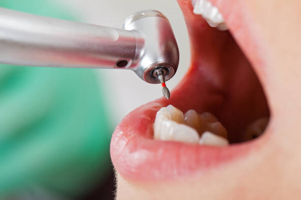 Best Walk-In Emergency Dentist in Golden Shores, AZ